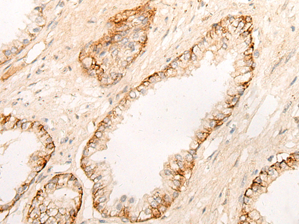 DPP9 Antibody