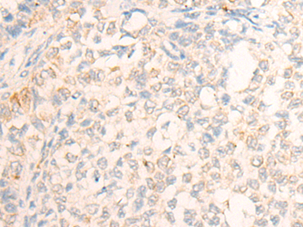 DPT Antibody