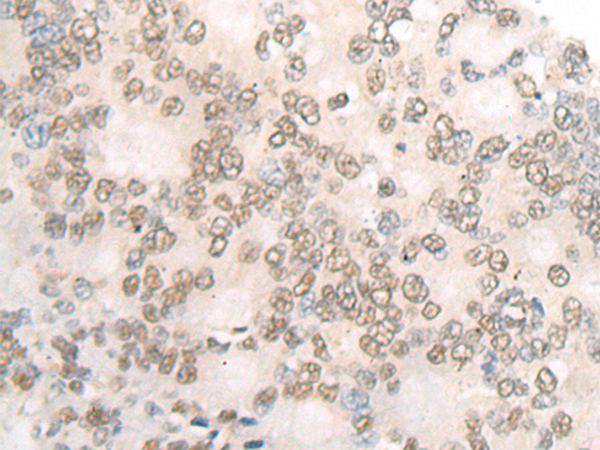 DR1 Antibody