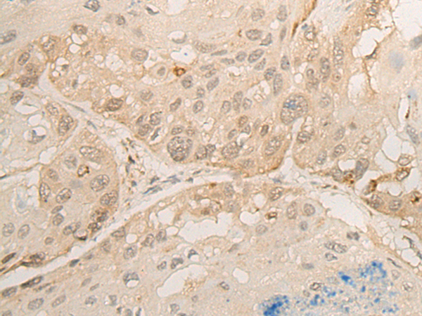 DROSHA Antibody