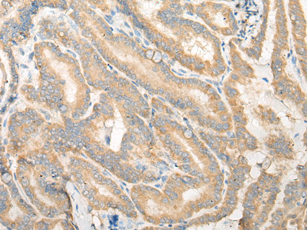 EPB41L4B Antibody