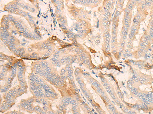 GDI2 Antibody