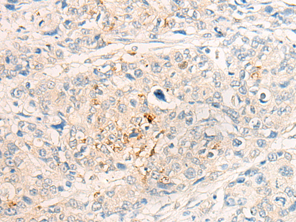 IL20RB Antibody