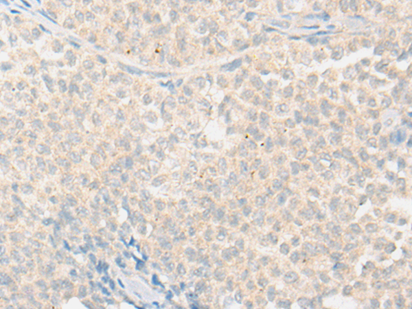 NR2F1 Antibody