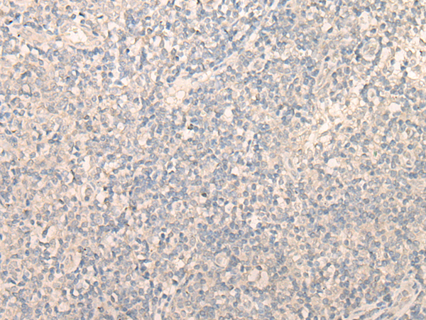 PITPNB Antibody