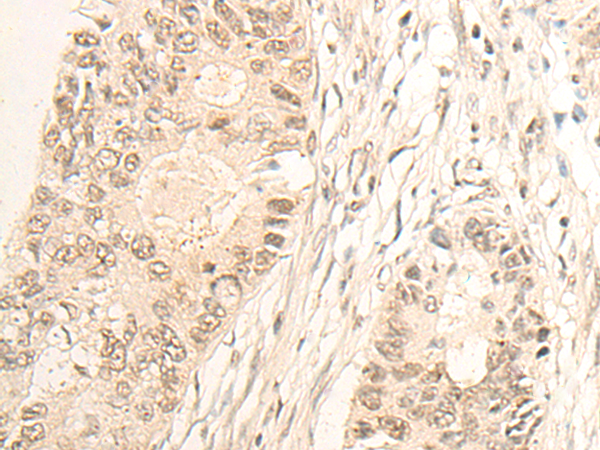 SLFN5 Antibody