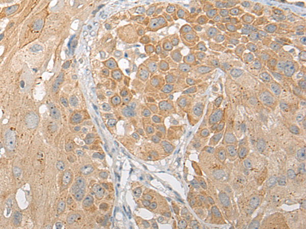 SNX6 Antibody