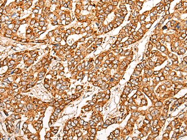 SPATA19 Antibody