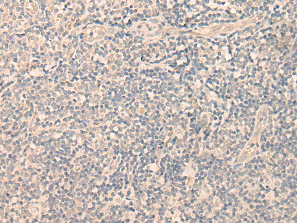 SPOCK3 Antibody