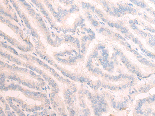 TBC1D2 Antibody