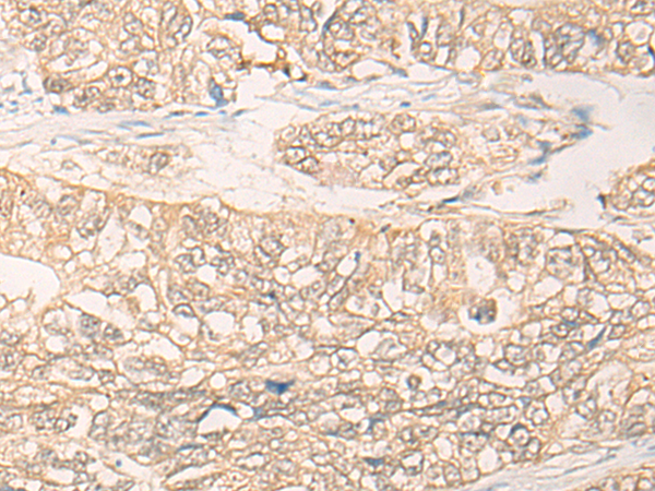 TKFC Antibody