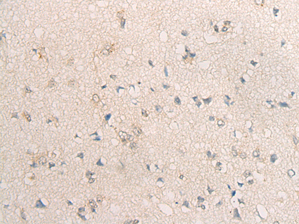 TSG101 Antibody