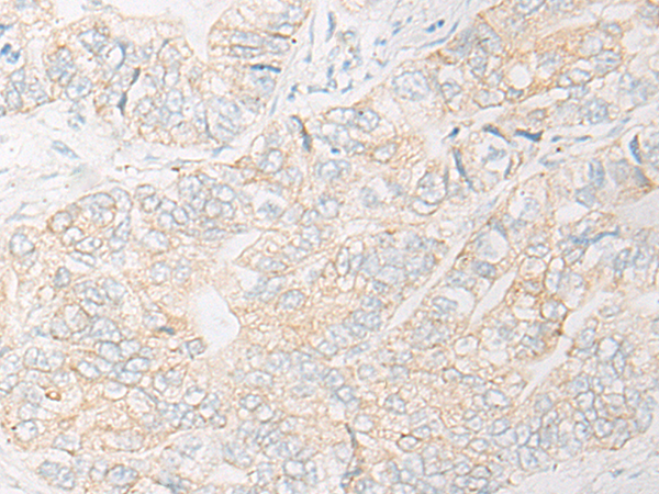 UQCR10 Antibody