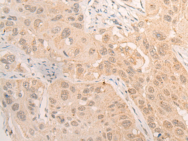 VDR Antibody