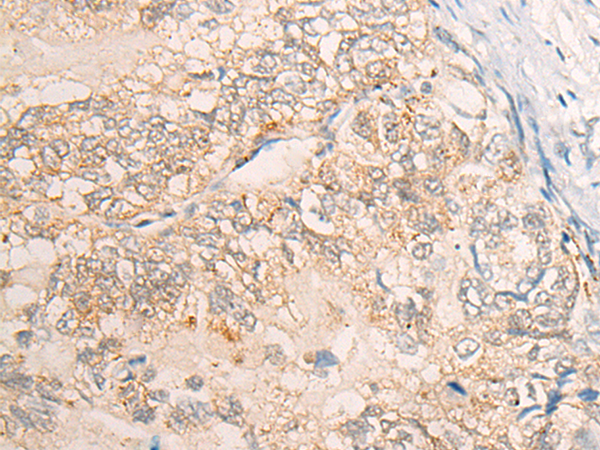 VPS18 Antibody