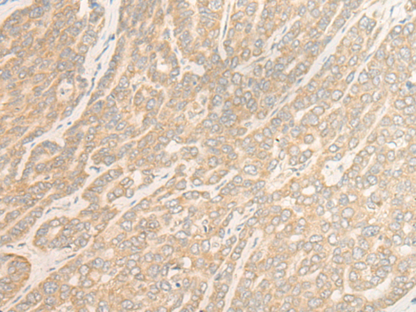 WDR6 Antibody
