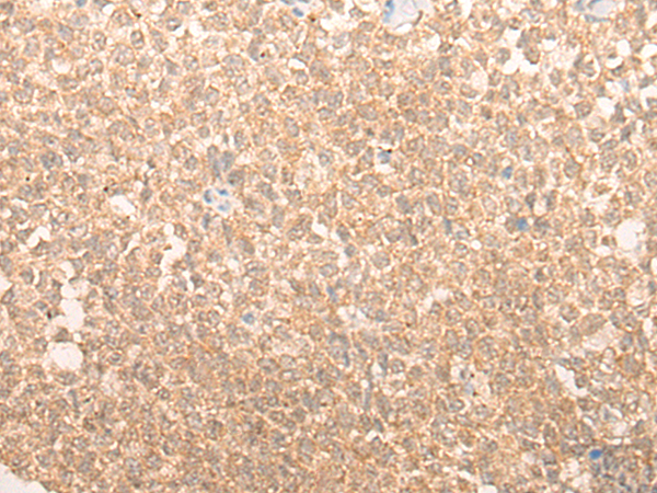 YAP1 Antibody
