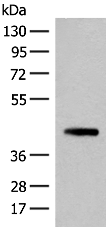 SMS Antibody