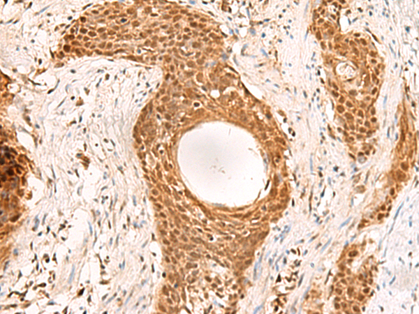 RMND5B Antibody