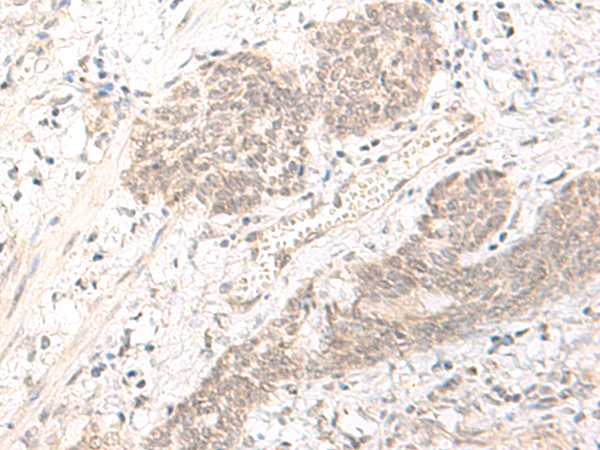 PBXIP1 Antibody