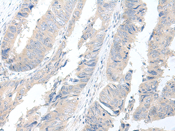 GBA2 Antibody