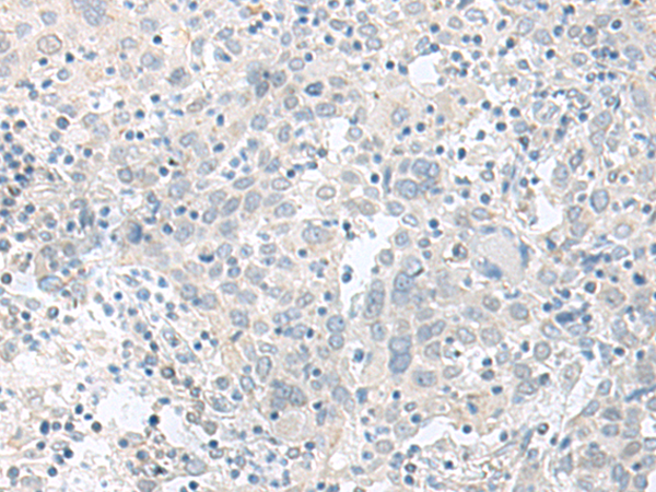 TIMM8A Antibody