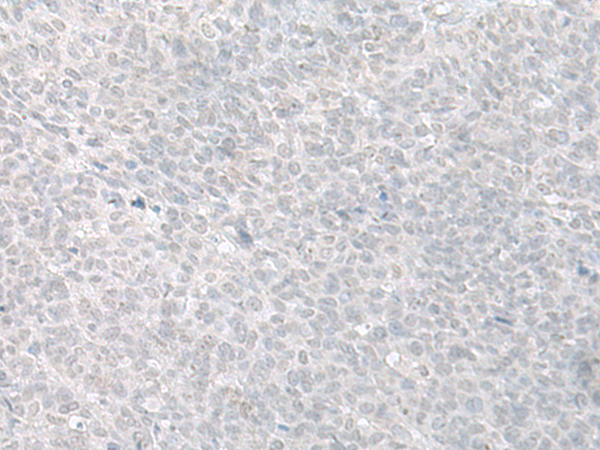 C8orf4 Antibody