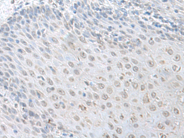 LSM10 Antibody