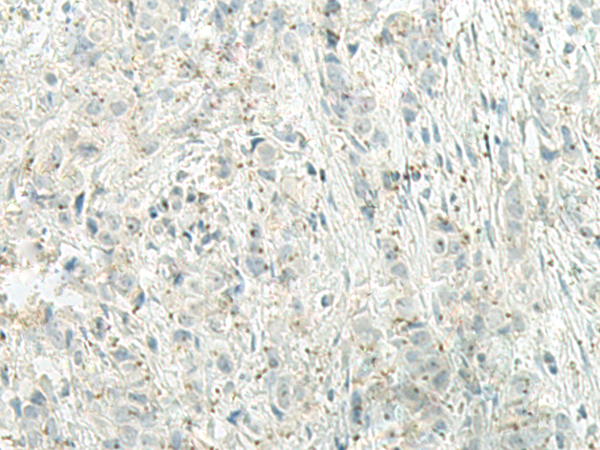 UQCC2 Antibody