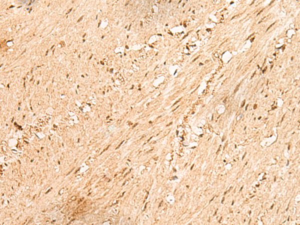 JPT2 Antibody