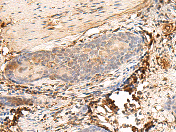 HLA-DQB1 Antibody
