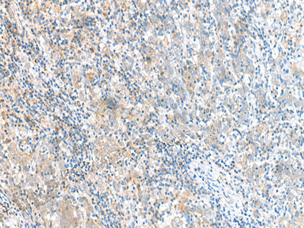 RMND5A Antibody