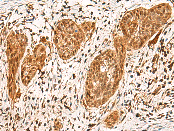 POLR1E Antibody