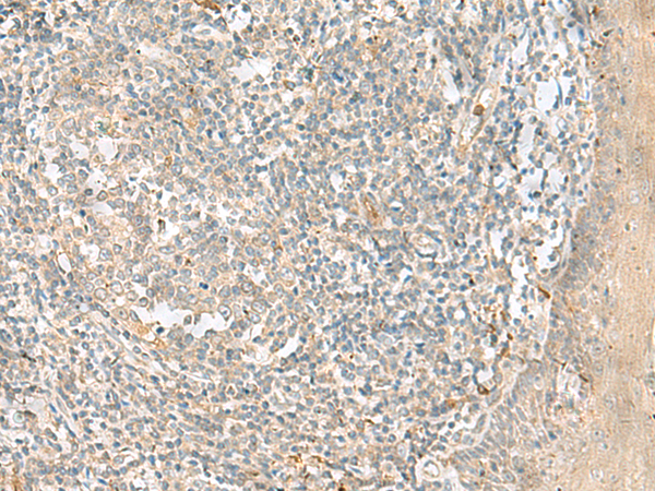 TTLL1 Antibody