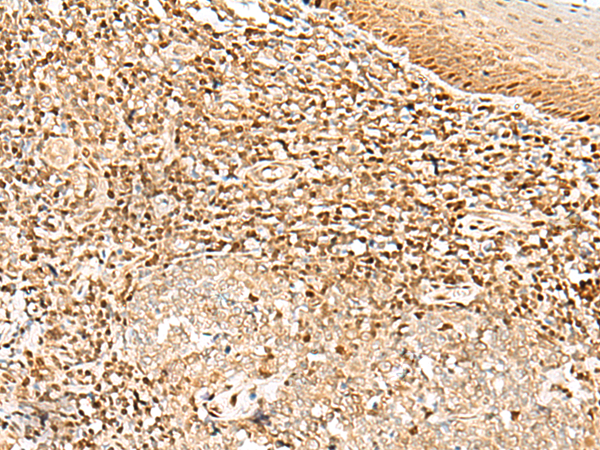 DNPEP Antibody