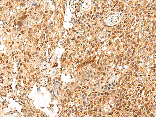 PAF1 Antibody