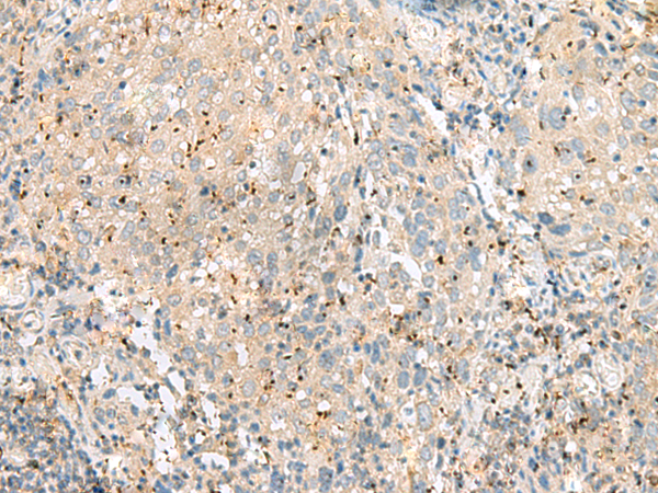 EIF3L Antibody