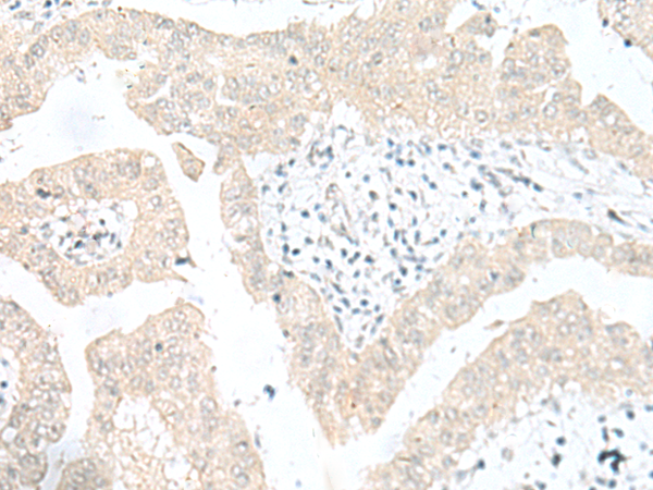 SNRPD1 Antibody