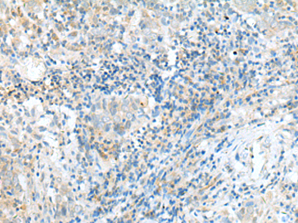 CPLX1 Antibody