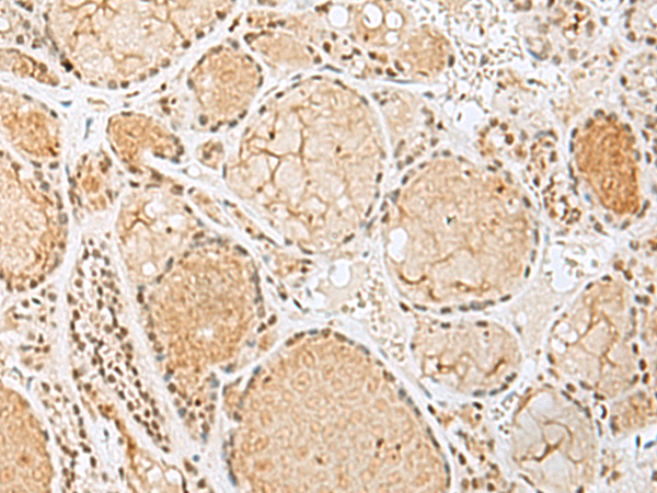HIST1H2BK Antibody