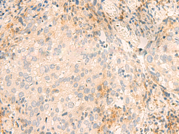 GSKIP Antibody