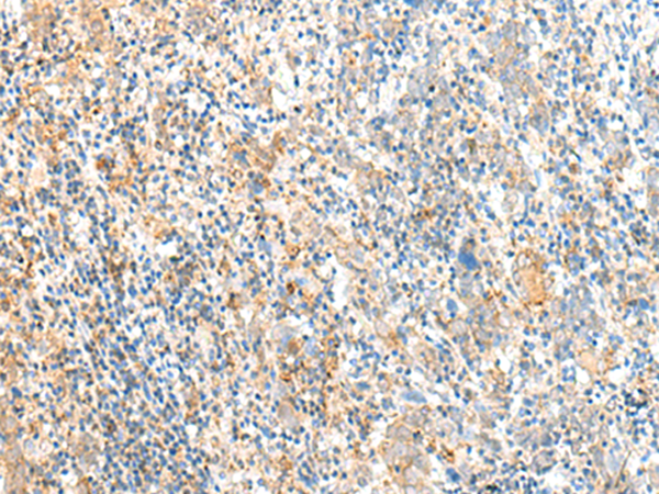 MCFD2 Antibody