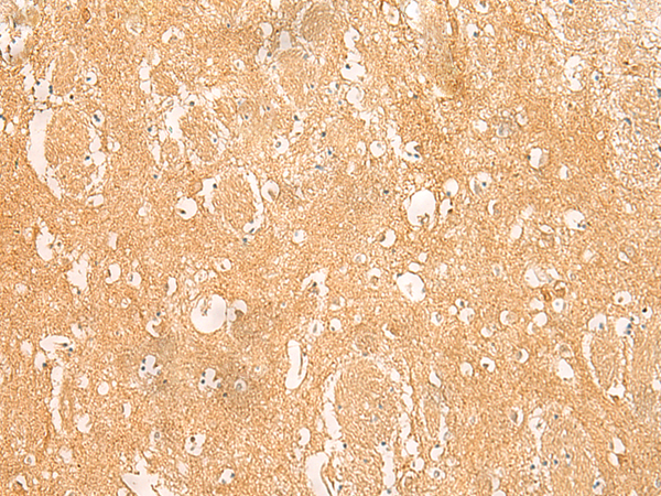 ARPC5L Antibody