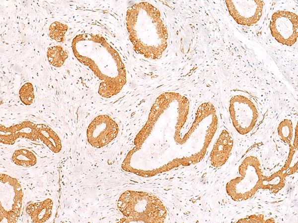 PFDN2 Antibody