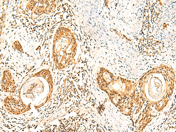 ZNF580 Antibody