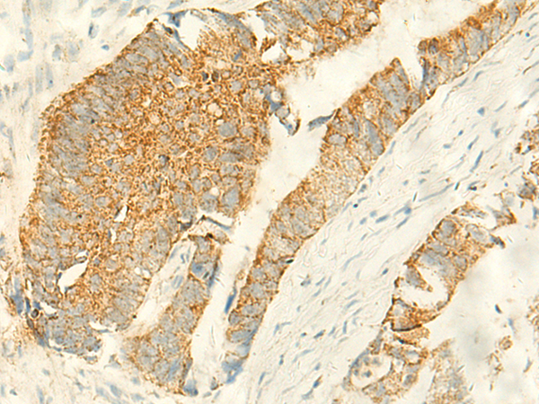 MPV17 Antibody