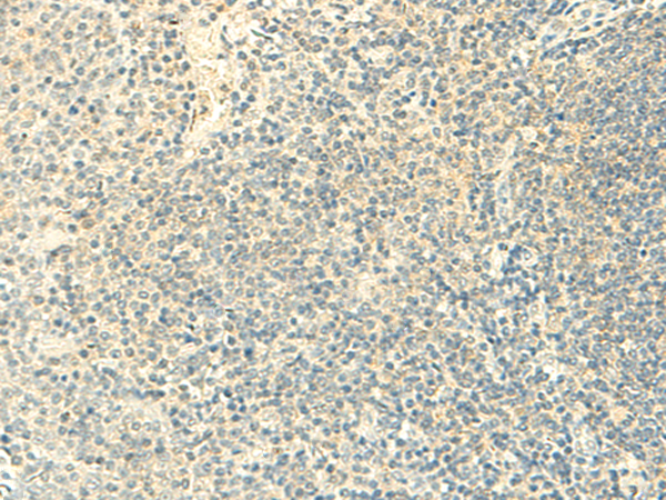 FMNL2 Antibody