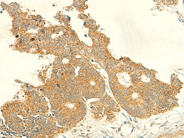 IFT27 Antibody