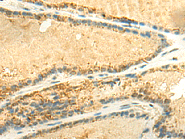 EEF1AKMT2 Antibody
