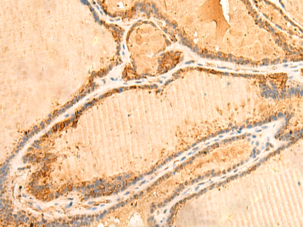 PPM1B Antibody